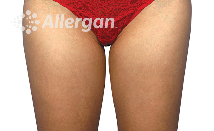 Female thigh image 1_Desk