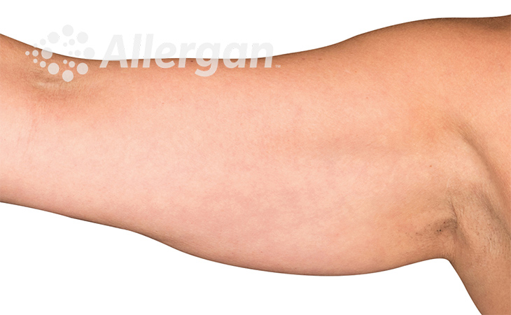 Female upper arm image 1_Desk