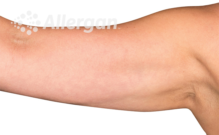 Female upper arm image 2_Desk